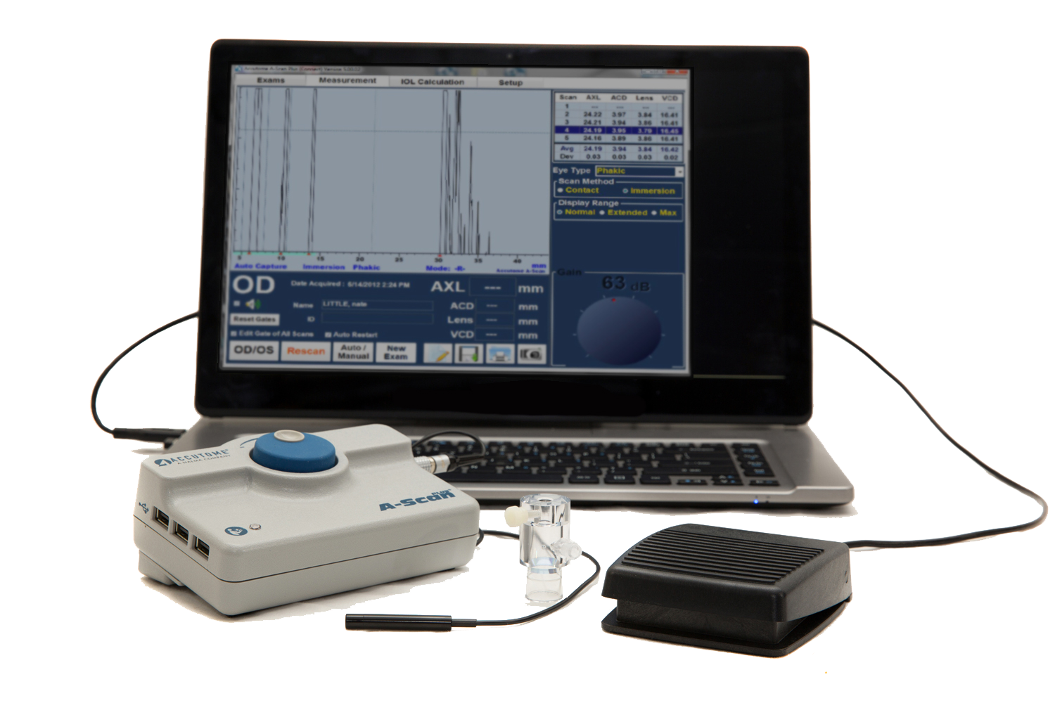 a-scan-with_screen